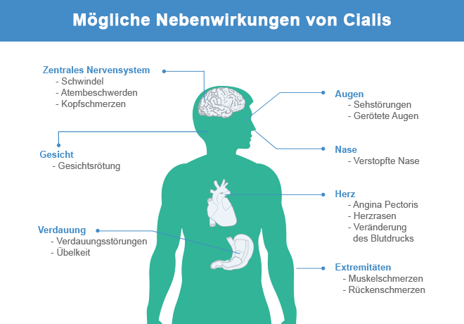 Nebenwirkungen von cialis 20mg